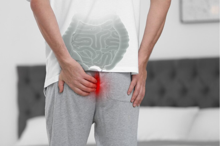 Piles Treatment image